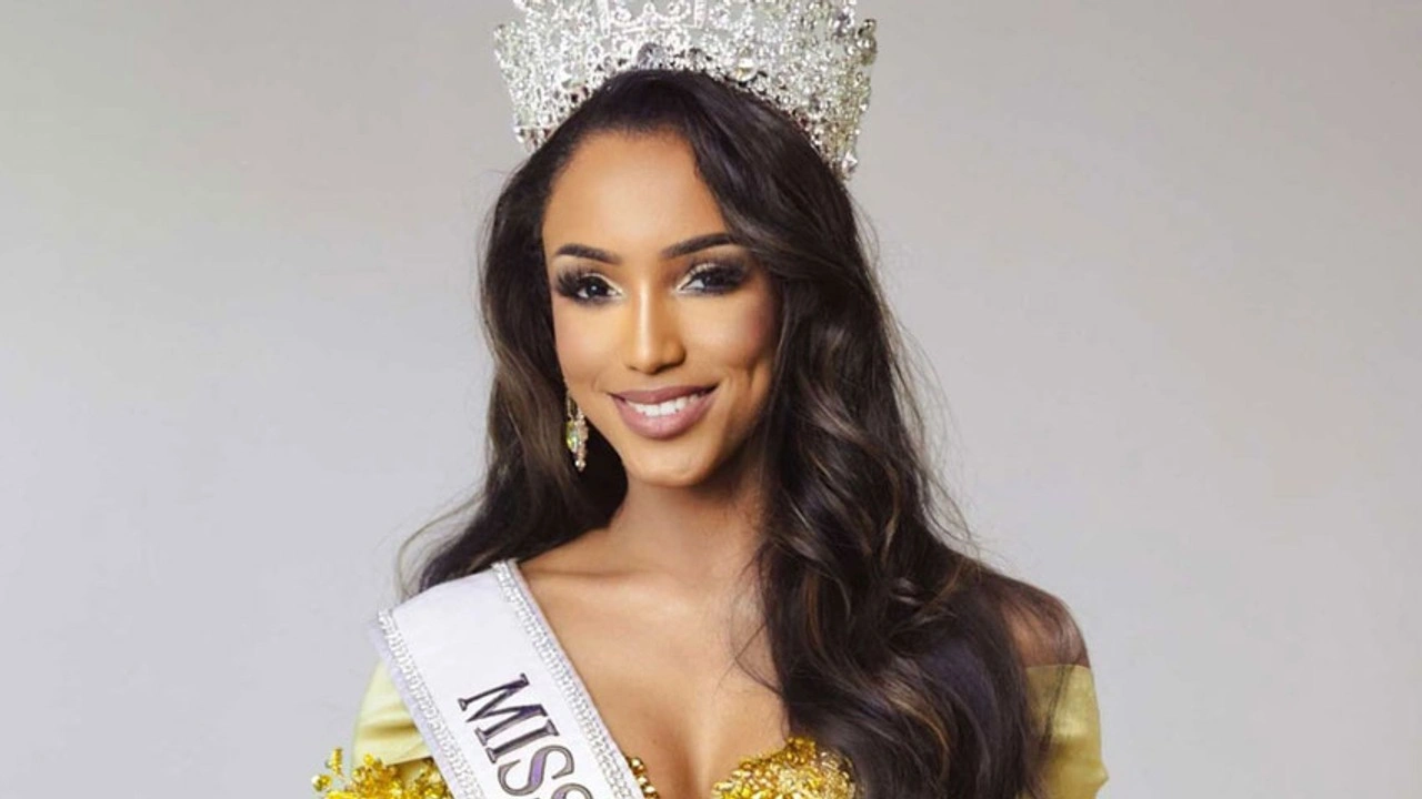 Podyumdan düşmüştü: Miss Universe güzeli yaşam mücadelesi veriyor