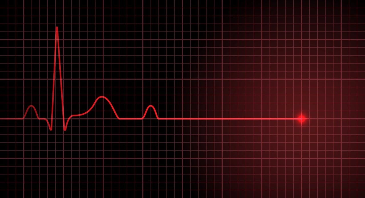 Selçuk Nadıç’ın ölüm sebebi “masif pulmoner emboli”