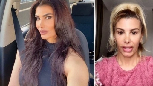 Türkücü Hatice botokstan zehirlendi! 'Bunu bir dişçiye yaptırdım'